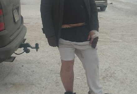 Мачете, розочка, грабёж, пожар и просто неадекват